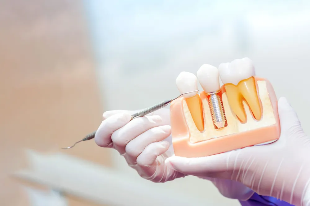 tandimplantat hillerød